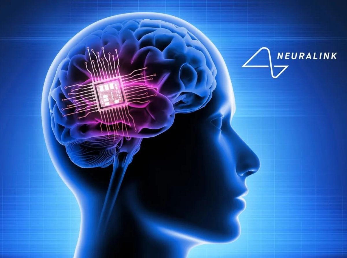 Neuralink